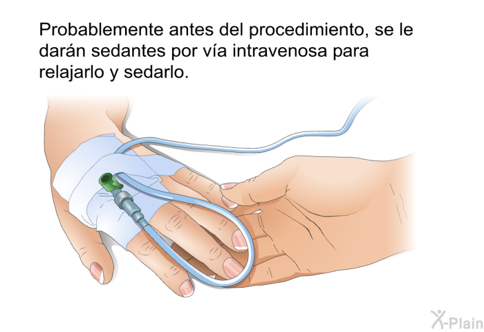 Probablemente antes del procedimiento, se le darn sedantes por va intravenosa para relajarlo y sedarlo.