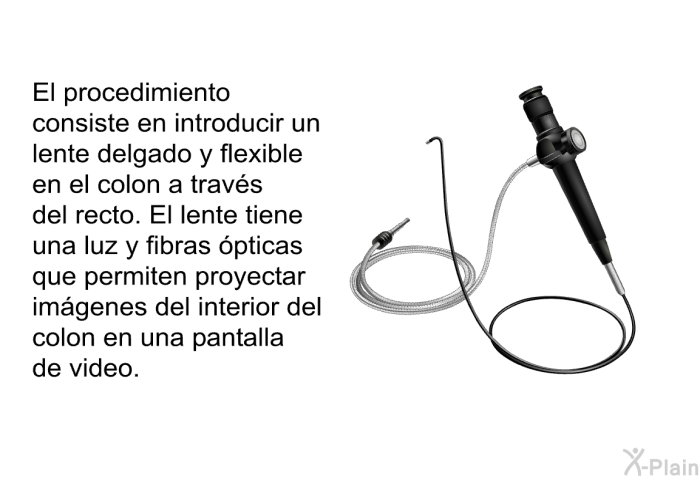 El procedimiento consiste en introducir un lente delgado y flexible en el colon a travs del recto. El lente tiene una luz y fibras pticas que permiten proyectar imgenes del interior del colon en una pantalla de video.