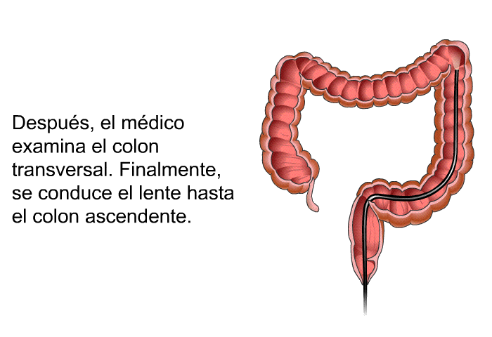 Despus, el mdico examina el colon transversal. Finalmente, se conduce el lente hasta el colon ascendente.