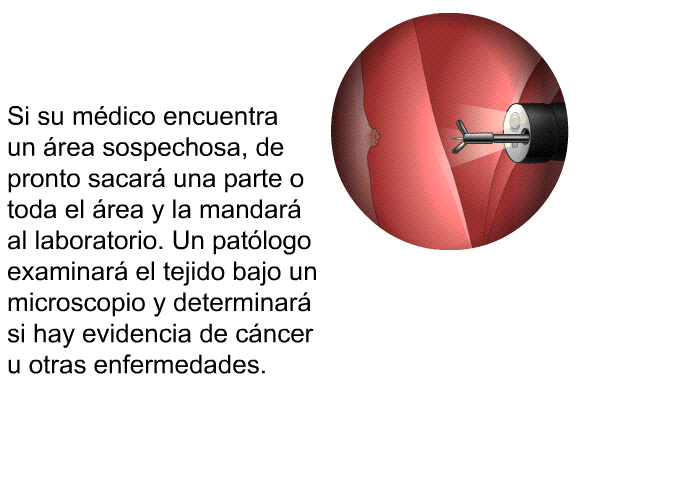 Si su mdico encuentra un rea sospechosa, de pronto sacar una parte o toda el rea y la mandar al laboratorio. Un patlogo examinar el tejido bajo un microscopio y determinar si hay evidencia de cncer u otras enfermedades.