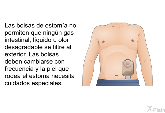Las bolsas de ostoma no permiten que ningn gas intestinal, lquido u olor desagradable se filtre al exterior. Las bolsas deben cambiarse con frecuencia y la piel que rodea el estoma necesita cuidados especiales.