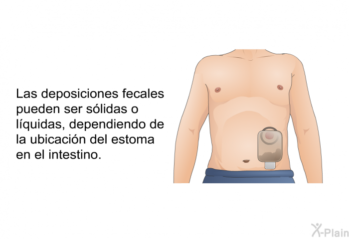Las deposiciones fecales pueden ser slidas o lquidas, dependiendo de la ubicacin del estoma en el intestino.