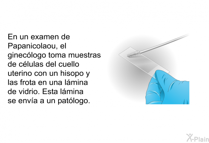 En un examen de Papanicolaou, el gineclogo toma muestras de clulas del cuello uterino con un hisopo y las frota en una lmina de vidrio. Esta lmina se enva a un patlogo.