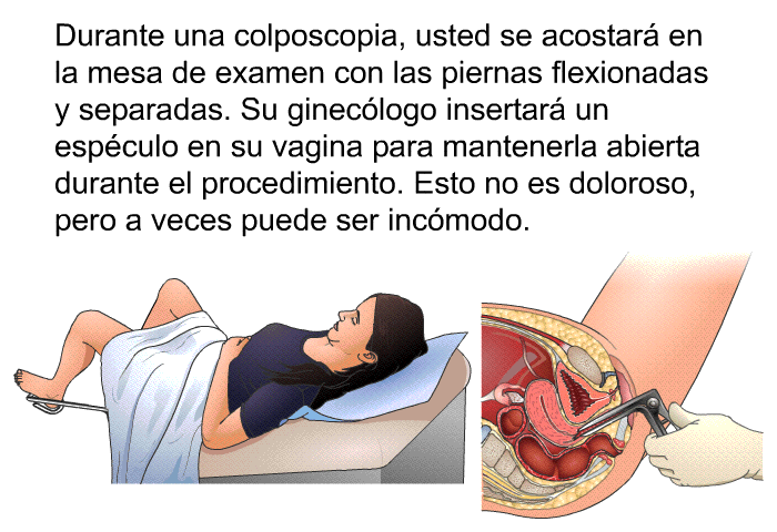 Durante una colposcopia, usted se acostar� en la mesa de examen con las piernas flexionadas y separadas. Su ginec�logo insertar� un esp�culo en su vagina para mantenerla abierta durante el procedimiento. Esto no es doloroso, pero a veces puede ser inc�modo.