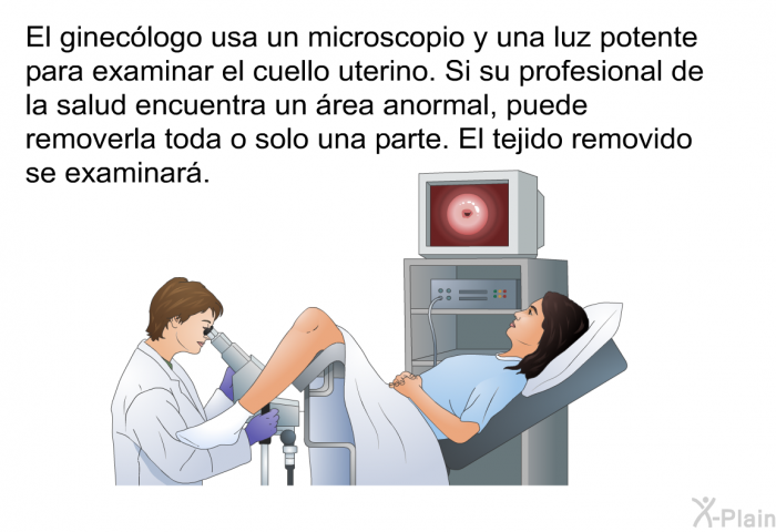 El ginec�logo usa un microscopio y una luz potente para examinar el cuello uterino. Si su profesional de la salud encuentra un �rea anormal, puede removerla toda o solo una parte. El tejido removido se examinar�.