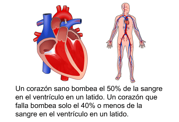 Un corazn sano bombea el 50% de la sangre en el ventrculo en un latido. Un corazn que falla bombea solo el 40% o menos de la sangre en el ventrculo en un latido.