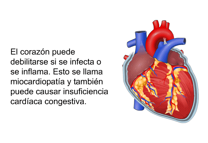 El corazn puede debilitarse si se infecta o se inflama. Esto se llama miocardiopata y tambin puede causar insuficiencia cardaca congestiva.