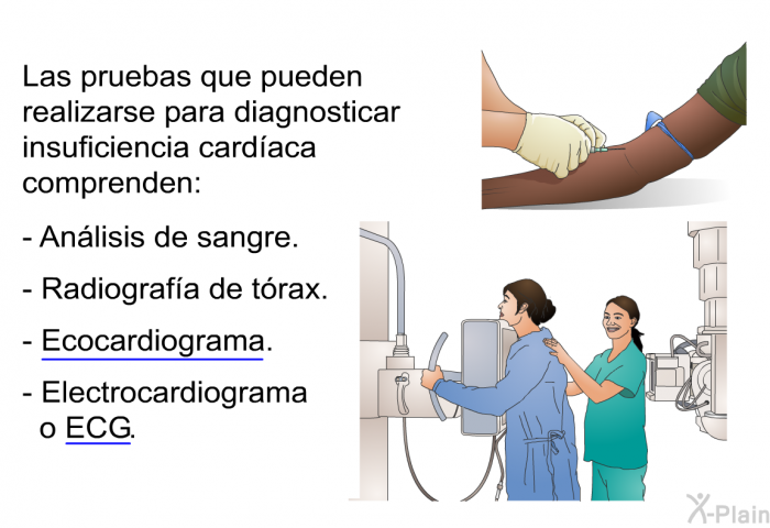 Las pruebas que pueden realizarse para diagnosticar insuficiencia cardaca comprenden:  Anlisis de sangre. Radiografa de trax. Ecocardiograma. Electrocardiograma o ECG.