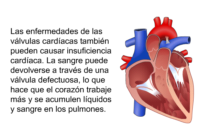 Las enfermedades de las vlvulas cardacas tambin pueden causar insuficiencia cardaca. La sangre puede devolverse a travs de una vlvula defectuosa, lo que hace que el corazn trabaje ms y se acumulen lquidos y sangre en los pulmones.
