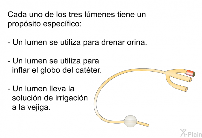 Cada uno de los tres lmenes tiene un propsito especfico:  Un lumen se utiliza para drenar orina. Un lumen se utiliza para inflar el globo del catter. Un lumen lleva la solucin de irrigacin a la vejiga.