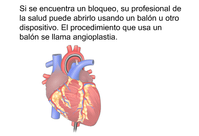 Si se encuentra un bloqueo, su profesional de la salud puede abrirlo usando un baln u otro dispositivo. El procedimiento que usa un baln se llama angioplastia.