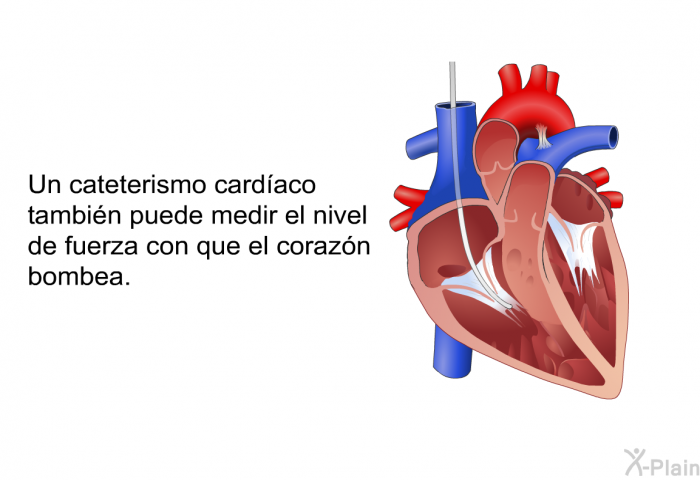 Un cateterismo cardaco tambin puede medir el nivel de fuerza con que el corazn bombea.