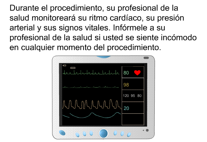 Durante el procedimiento, su profesional de la salud monitorear su ritmo cardaco, su presin arterial y sus signos vitales. Infrmele a su profesional de la salud si usted se siente incmodo en cualquier momento del procedimiento.