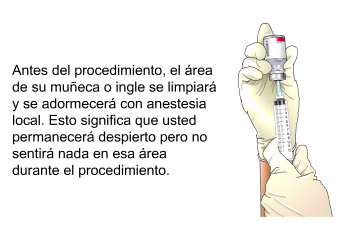 Antes del procedimiento, el rea de su mueca o ingle se limpiar y se adormecer con anestesia local. Esto significa que usted permanecer despierto pero no sentir nada en esa rea durante el procedimiento.