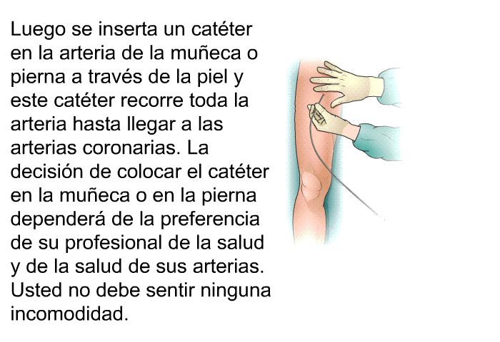 Luego se inserta un catter en la arteria de la mueca o pierna a travs de la piel y este catter recorre toda la arteria hasta llegar a las arterias coronarias. La decisin de colocar el catter en la mueca o en la pierna depender de la preferencia de su profesional de la salud y de la salud de sus arterias. Usted no debe sentir ninguna incomodidad.