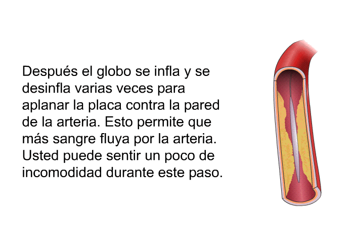 Despu�s el globo se infla y se desinfla varias veces para aplanar la placa contra la pared de la arteria. Esto permite que m�s sangre fluya por la arteria. Usted puede sentir un poco de incomodidad durante este paso.