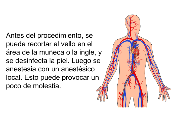 Antes del procedimiento, se puede recortar el vello en el �rea de la mu�eca o la ingle, y se desinfecta la piel.&nbsp;Luego se anestesia con un anest�sico local. Esto puede provocar un poco de molestia.