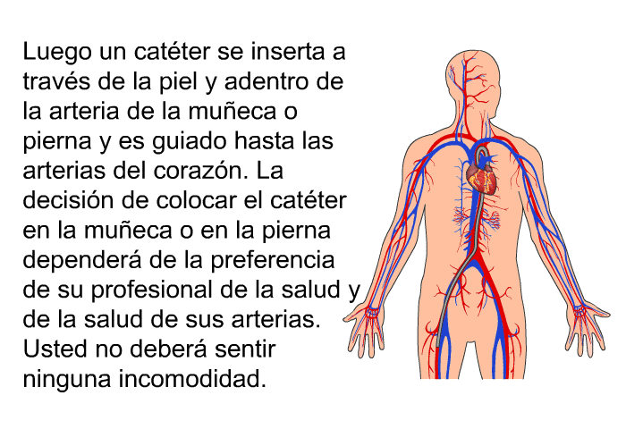 Luego un cat�ter se inserta a trav�s de la piel y adentro de la arteria de la mu�eca o pierna y es guiado hasta las arterias del coraz�n. La decisi�n de colocar el cat�ter en la mu�eca o en la pierna depender� de la preferencia de su profesional de la salud y de la salud de sus arterias. Usted no deber� sentir ninguna incomodidad.