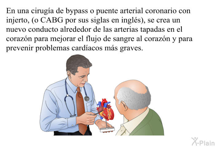 En una ciruga de bypass o puente arterial coronario con injerto, (o CABG por sus siglas en ingls), se crea un nuevo conducto alrededor de las arterias tapadas en el corazn para mejorar el flujo de sangre al corazn y para prevenir problemas cardacos ms graves.