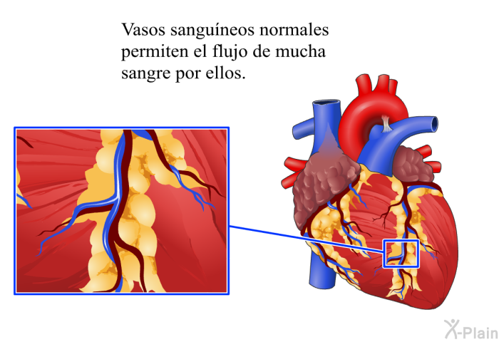 Vasos sanguneos normales permiten el flujo de mucha sangre por ellos.