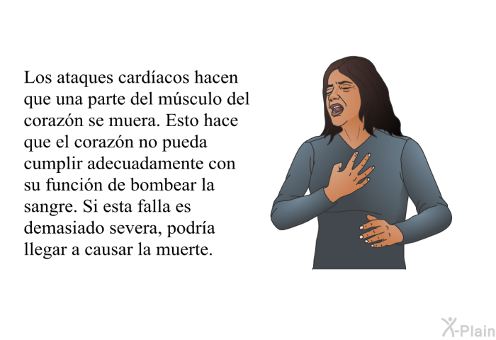 Los ataques cardacos hacen que una parte del msculo del corazn se muera. Esto hace que el corazn no pueda cumplir adecuadamente con su funcin de bombear la sangre. Si esta falla es demasiado severa, podra llegar a causar la muerte.