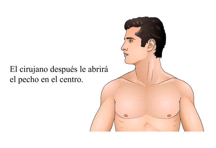 El cirujano despus le abrir el pecho en el centro.