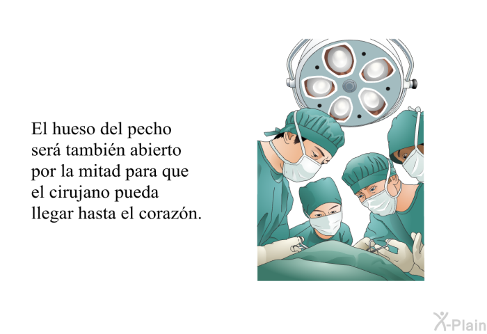 El hueso del pecho ser tambin abierto por la mitad para que el cirujano pueda llegar hasta el corazn.