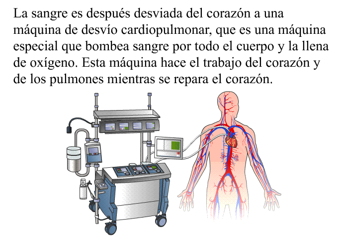 La sangre es despus desviada del corazn a una mquina de desvo cardiopulmonar, que es una mquina especial que bombea sangre por todo el cuerpo y la llena de oxgeno. Esta mquina hace el trabajo del corazn y de los pulmones mientras se repara el corazn.
