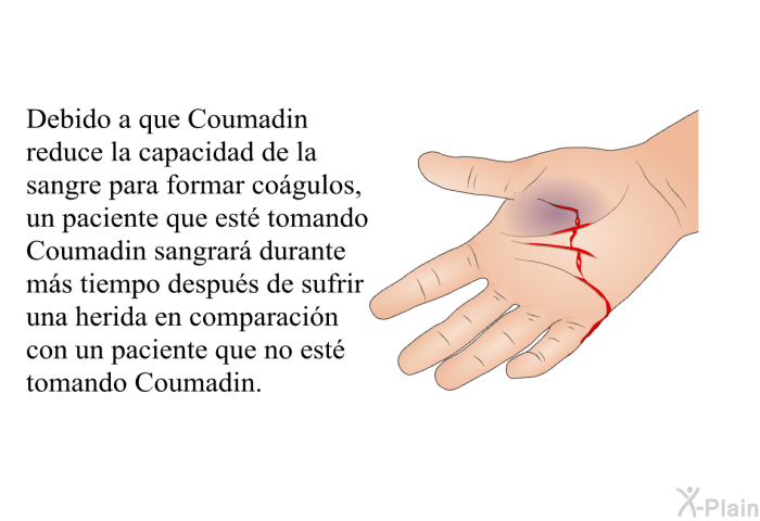 Debido a que Coumadin reduce la capacidad de la sangre para formar cogulos, un paciente que est tomando Coumadin sangrar durante ms tiempo despus de sufrir una herida en comparacin con un paciente que no est tomando Coumadin.