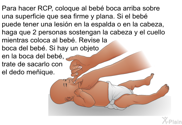 Para hacer RCP, coloque al beb boca arriba sobre una superficie que sea firme y plana. Si el beb puede tener una lesin en la espalda o en la cabeza, haga que 2 personas sostengan la cabeza y el cuello mientras coloca al beb. Revise la boca del beb. Si hay un objeto en la boca del beb, trate de sacarlo con el dedo meique.