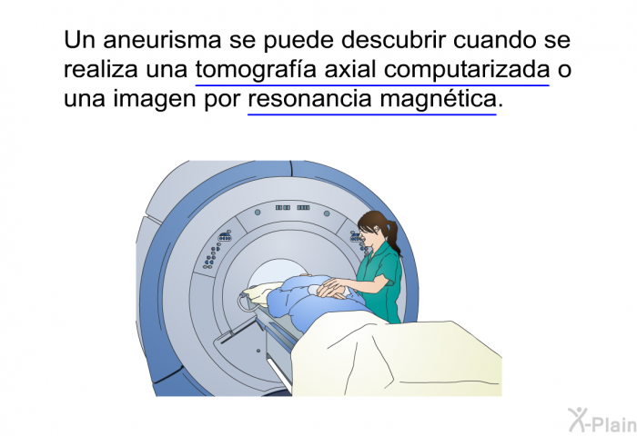 Un aneurisma se puede descubrir cuando se realiza una tomografa axial computarizada o una imagen por resonancia magntica.