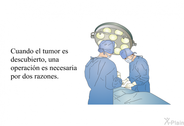 Cuando el tumor es descubierto, una operacin es necesaria por dos razones.