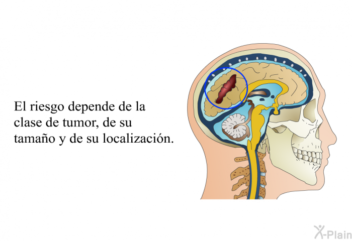 El riesgo depende de la clase de tumor, de su tamao y de su localizacin.