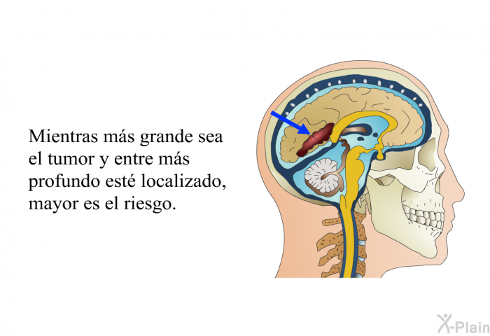 Mientras ms grande sea el tumor y entre ms profundo est localizado, mayor es el riesgo.