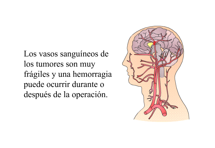 Los vasos sanguneos de los tumores son muy frgiles y una hemorragia puede ocurrir durante o despus de la operacin.