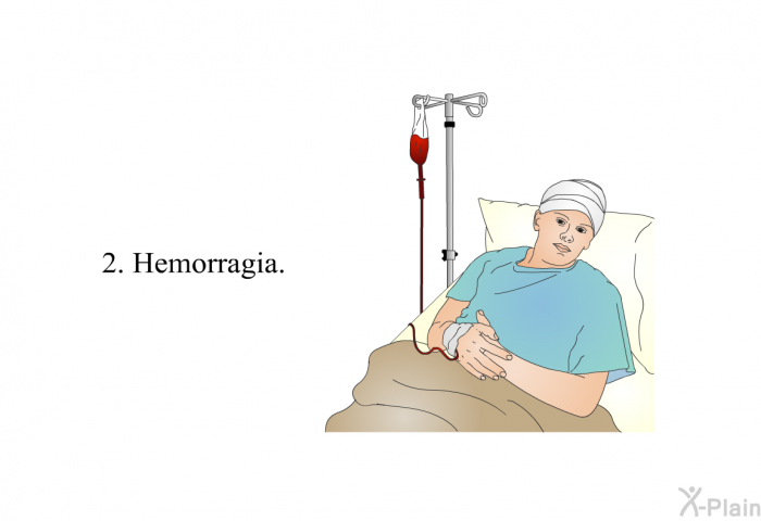 Hemorragia.