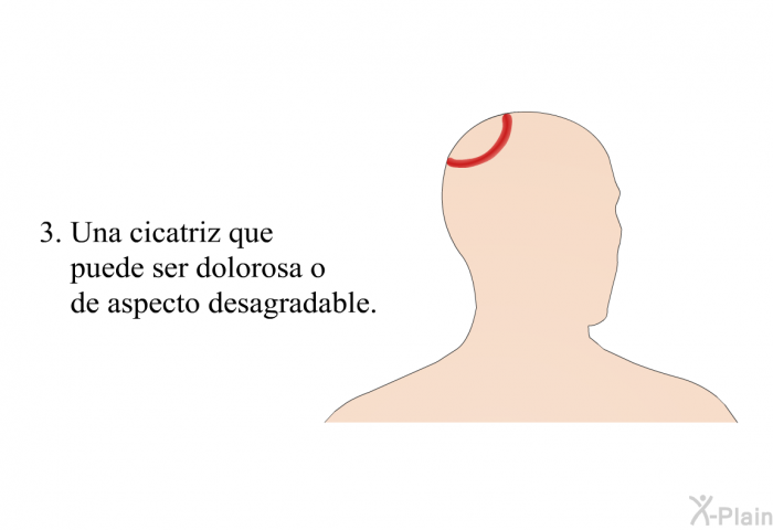 Una cicatriz que puede ser dolorosa o de aspecto desagradable.