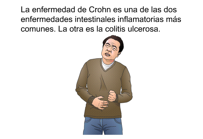 La enfermedad de Crohn es una de las dos enfermedades intestinales inflamatorias ms comunes. La otra es la colitis ulcerosa.