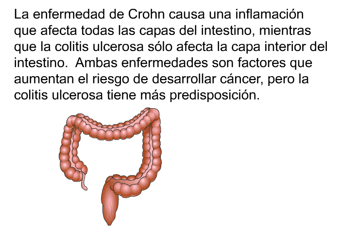 La enfermedad de Crohn causa una inflamacin que afecta todas las capas del intestino, mientras que la colitis ulcerosa slo afecta la capa interior del intestino. Ambas enfermedades son factores que aumentan el riesgo de desarrollar cncer, pero la colitis ulcerosa tiene ms predisposicin.