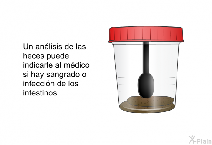 Un anlisis de las heces puede indicarle al mdico si hay sangrado o infeccin de los intestinos.
