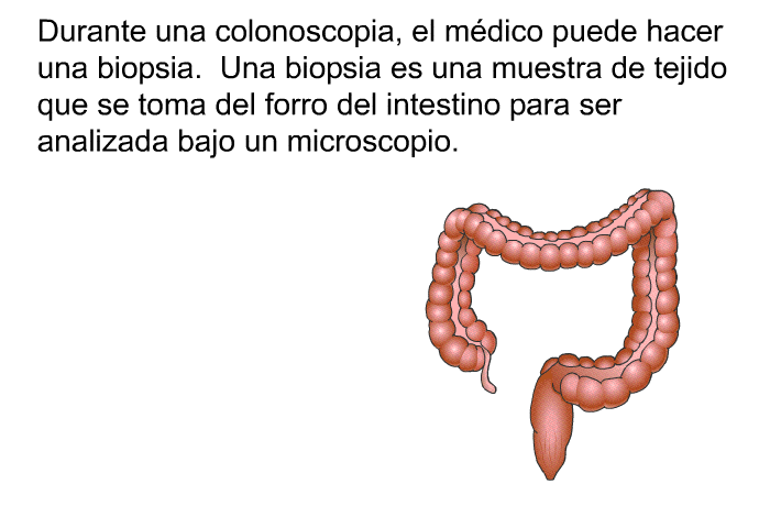 Durante una colonoscopia, el mdico puede hacer una biopsia. Una biopsia es una muestra de tejido que se toma del forro del intestino para ser analizada bajo un microscopio.