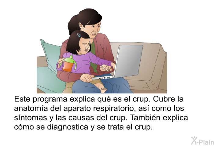 Esta informacin acerca de su salud explica qu es el crup. Cubre la anatoma del aparato respiratorio, as como los sntomas y las causas del crup. Tambin explica cmo se diagnostica y se trata el crup.