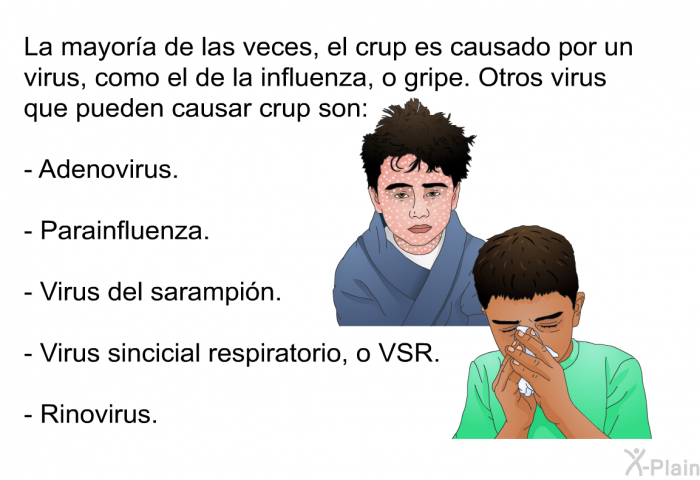 La mayor�a de las veces, el crup es causado por un virus, como el de la influenza, o gripe. Otros virus que pueden causar crup son:  Adenovirus. Parainfluenza. Virus del sarampi�n. Virus sincicial respiratorio, o VSR. Rinovirus.