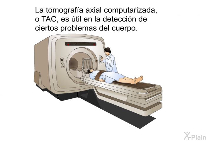 La tomografa axial computarizada, o TAC, es til en la deteccin de ciertos problemas del cuerpo.