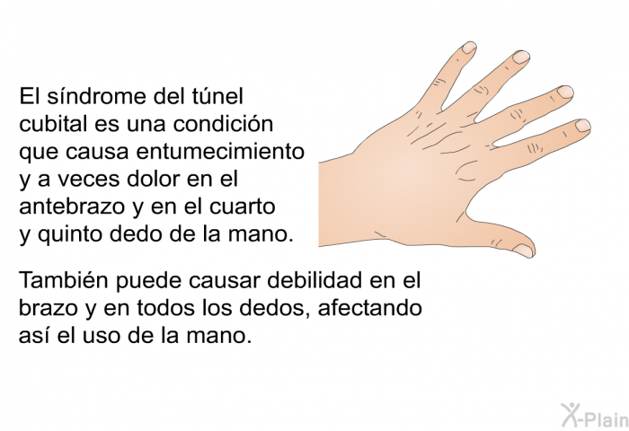El sndrome del tnel cubital es una condicin que causa entumecimiento y a veces dolor en el antebrazo y en el cuarto y quinto dedo de la mano. Tambin puede causar debilidad en el brazo y en todos los dedos, afectando as el uso de la mano.
