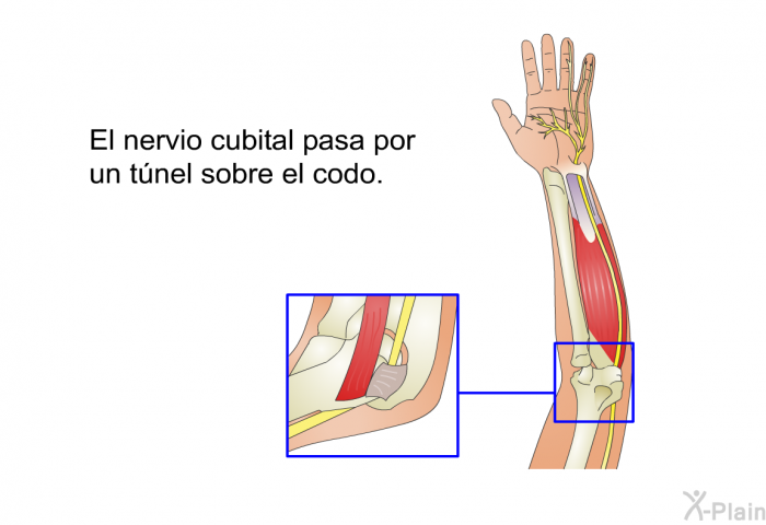 El nervio cubital pasa por un tnel sobre el codo.