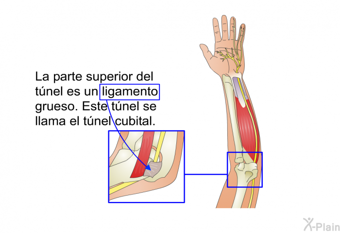 La parte superior del tnel es un ligamento grueso. Este tnel se llama el tnel cubital.