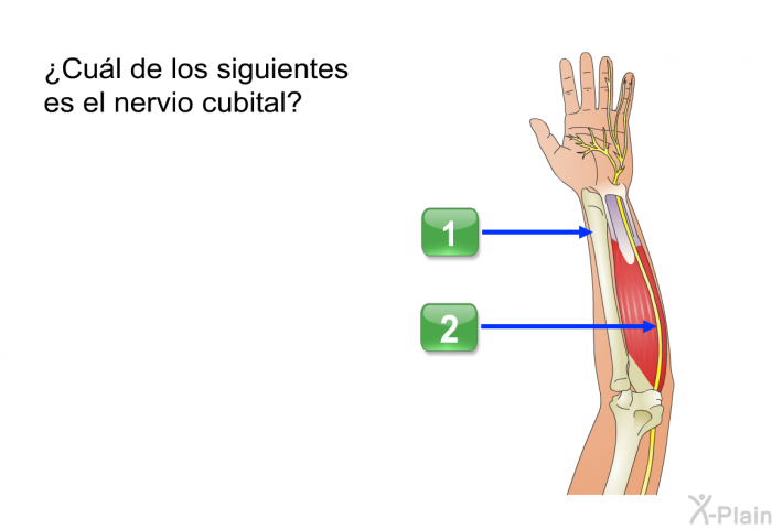 ¿Cul de los siguientes es el nervio cubital? Presione A o B.