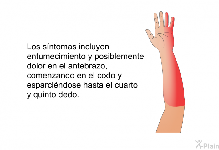 Los sntomas incluyen entumecimiento y posiblemente dolor en el antebrazo, comenzando en el codo y esparcindose hasta el cuarto y quinto dedo.