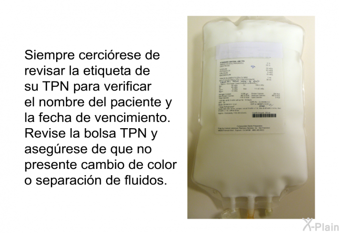 Siempre cercirese de revisar la etiqueta de su TPN para verificar el nombre del paciente y la fecha de vencimiento. Revise la bolsa TPN y asegrese de que no presente cambio de color o separacin de fluidos.